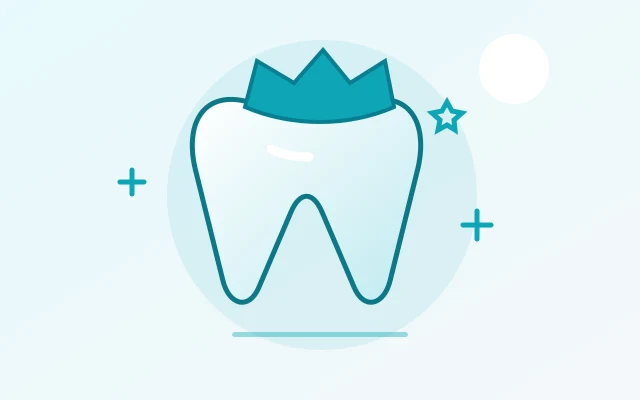 Illustration of a tooth with a crown
